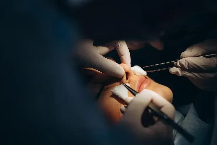 Sabe como a Rinoplastia pode ser feita?