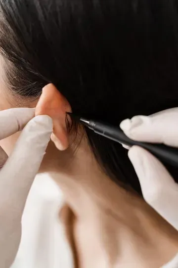 Otoplastia: O fim da Orelha de Abano