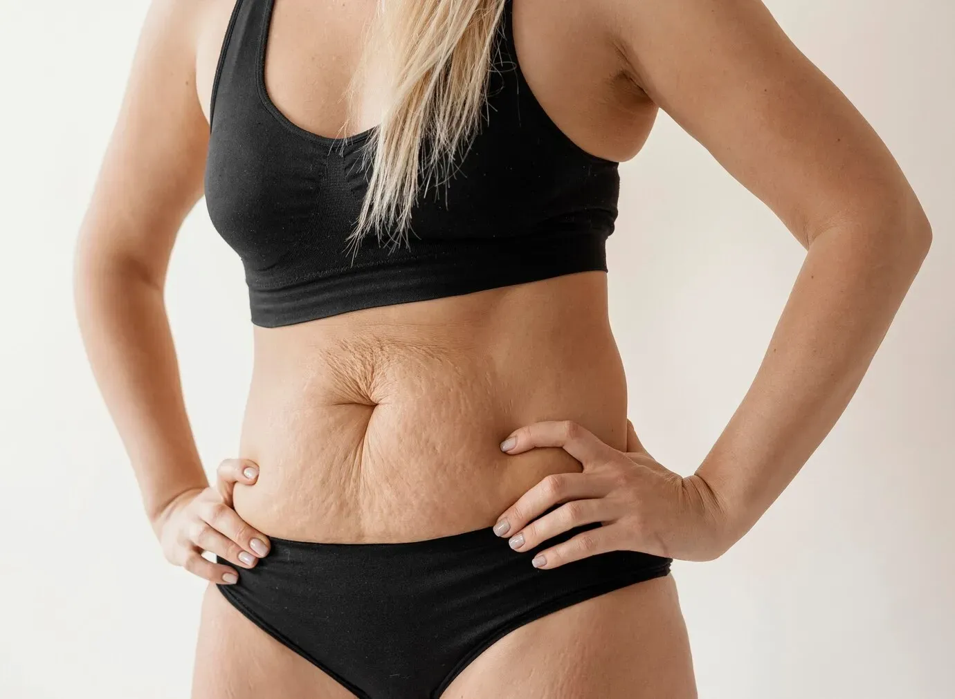 Como posso tratar a flacidez abdominal?