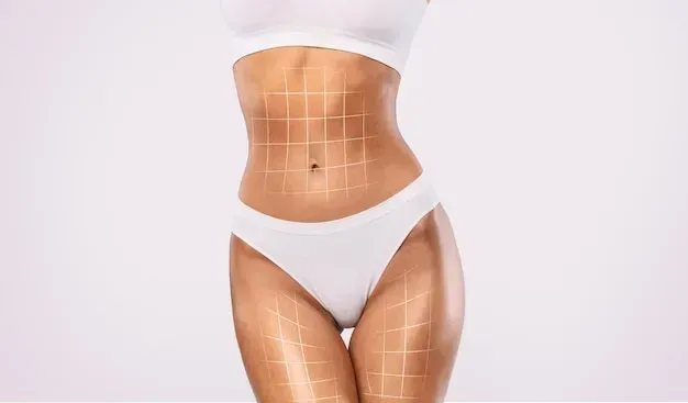 Lipo HD — Dr. Vitor Nunes