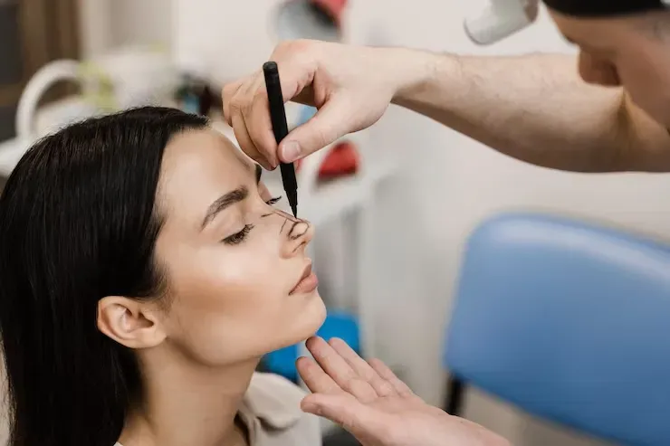 Saiba mais sobre Rinoplastia Minimalista – Teorinoplastia