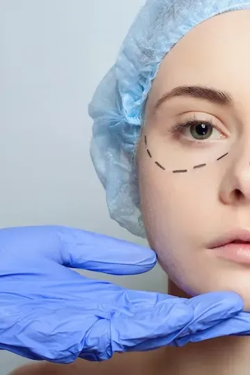Saiba mais sobre a Cirurgia do Olhar