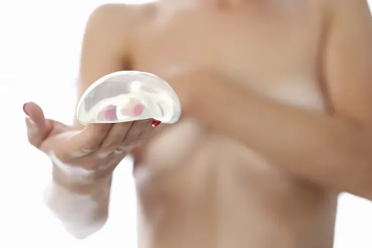 Mamoplastia Submuscular, o que você precisa saber