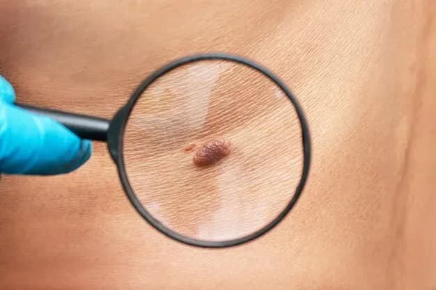 Desvendando o Melanoma: Conheça os Sinais e Previna-se