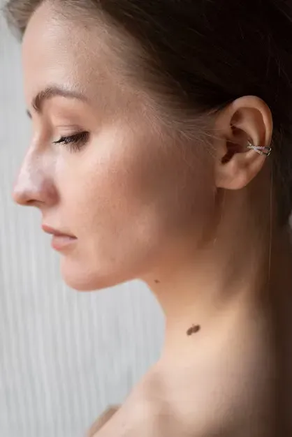 Já ouviu falar em CBC (Carcinoma Basocelular)?