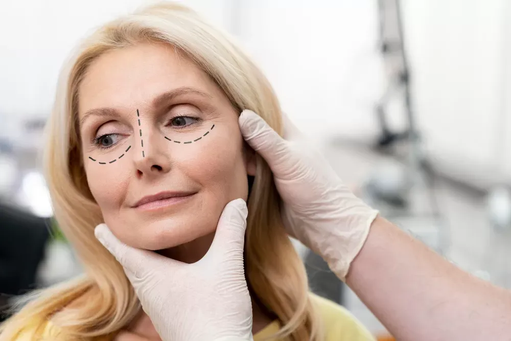 Blefaroplastia: Saiba tudo sobre a cirurgia das pálpebras
