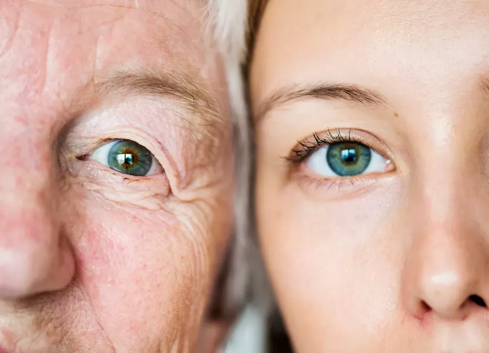 Blefaroplastia: Saiba tudo sobre a cirurgia das pálpebras