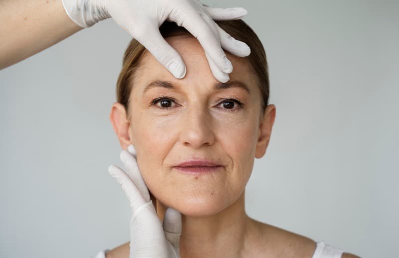 Saiba tudo sobre Lifting facial