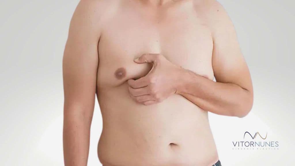 Saiba mais sobre Mamoplastia Masculinizante