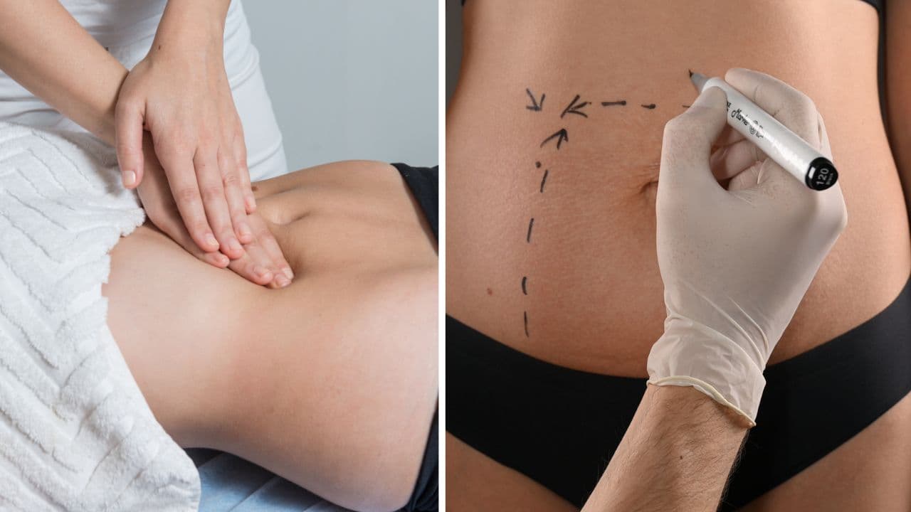 Drenagem Linfática e Cirurgia Plástica