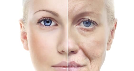 Tipos de Blefaroplastia