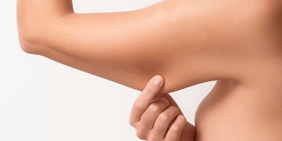 Saiba mais sobre Braquioplastia ou Lifting dos braços