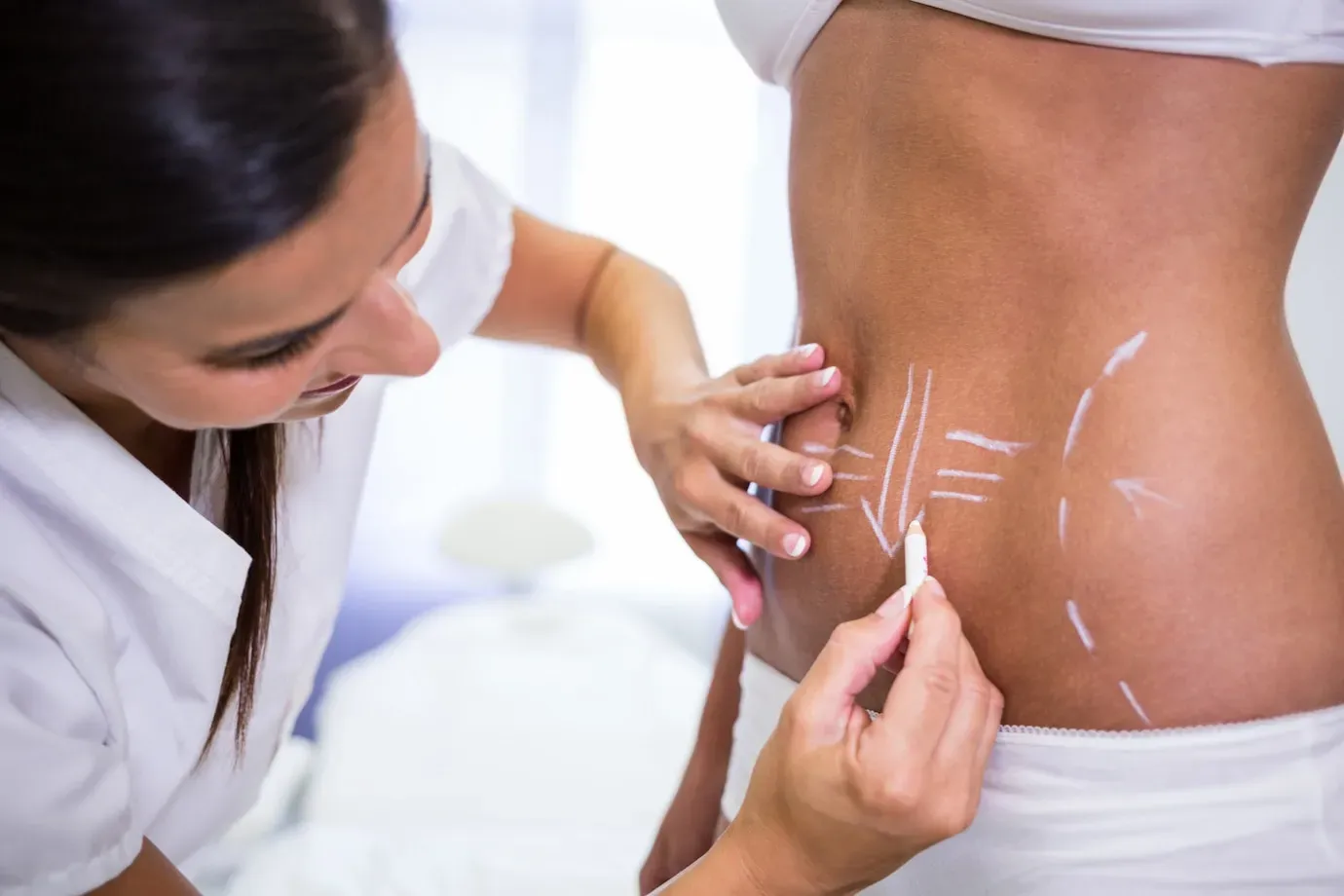 Diferença entre lipoaspiração e lipoescultura