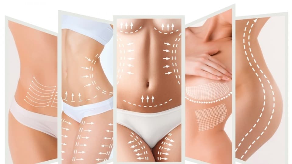 Em quais áreas do corpo a Lipoaspiração pode ser feita?