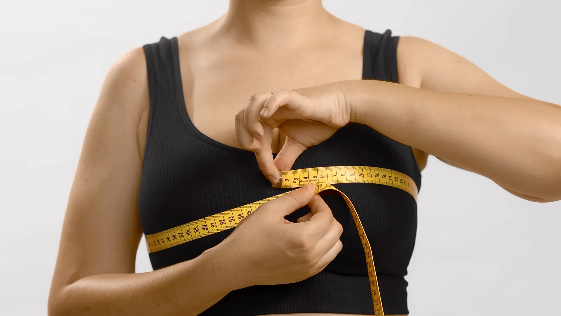 MAMOPLASTIA REDUTORA — Mamas