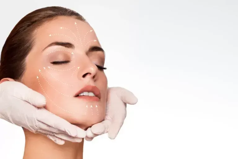 LIFTING FACIAL (RITIDOPLASTIA) — Face